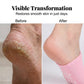 Moisturizing Gel Spa Socks